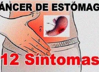 cáncer