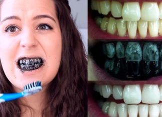 dientes
