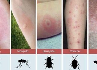 insectos