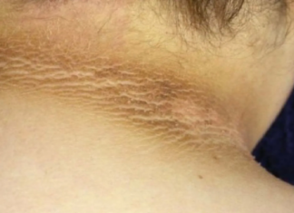cuello