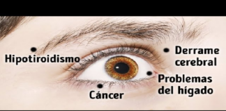 ojos